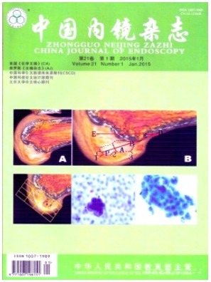 中国内镜